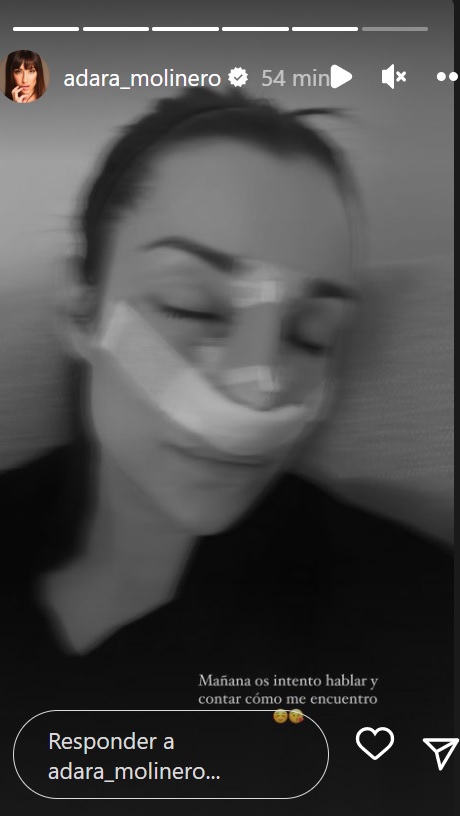 Adara Molinero reaparece tras someterse a una rinoplastia : Entretenimiento de España
