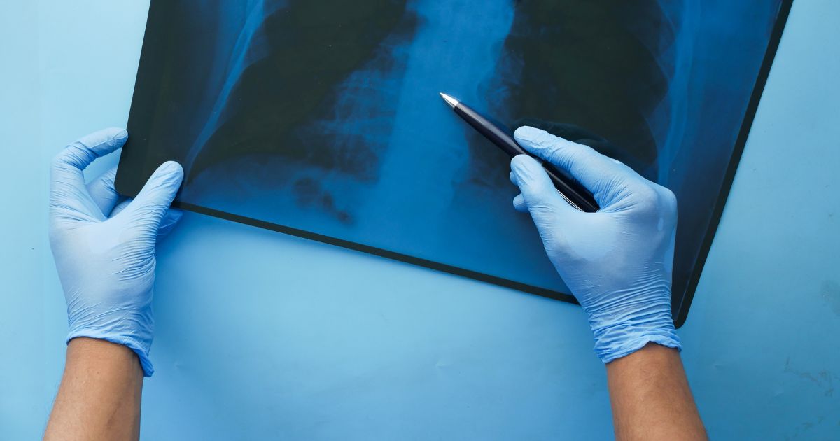 Asi fue la cirugia sin precedentes de medicos españoles para que un niño volviese a mover el brazo : Trending de Colombia