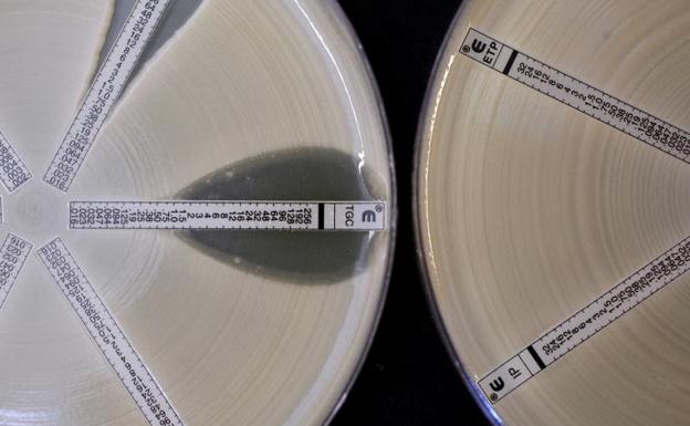 La OMS alerta del elevado aumento de las resistencias a los antibioticos en el mundo : Trending de Colombia